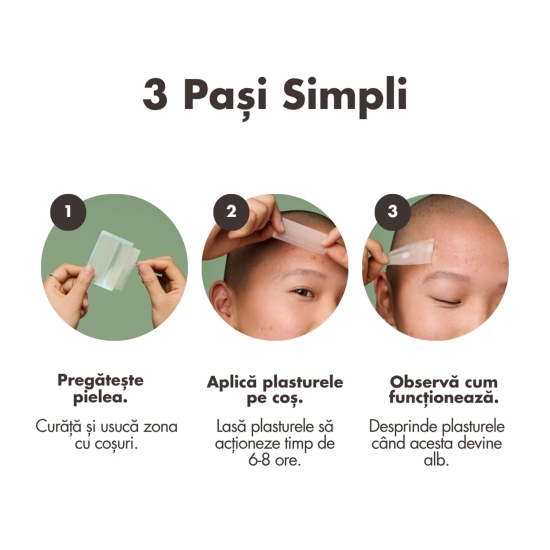 Plasturi hidrocoloidali pentru coșuri, 10 buc